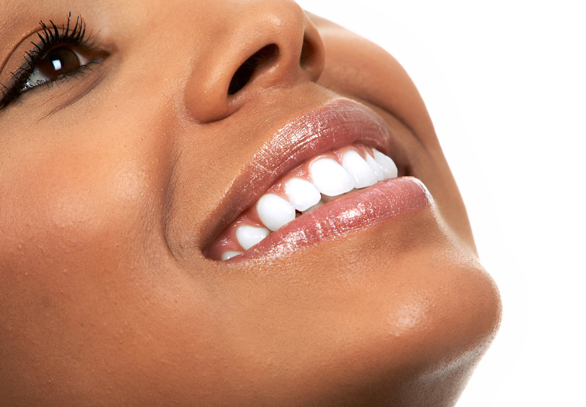 Clareamento Dental