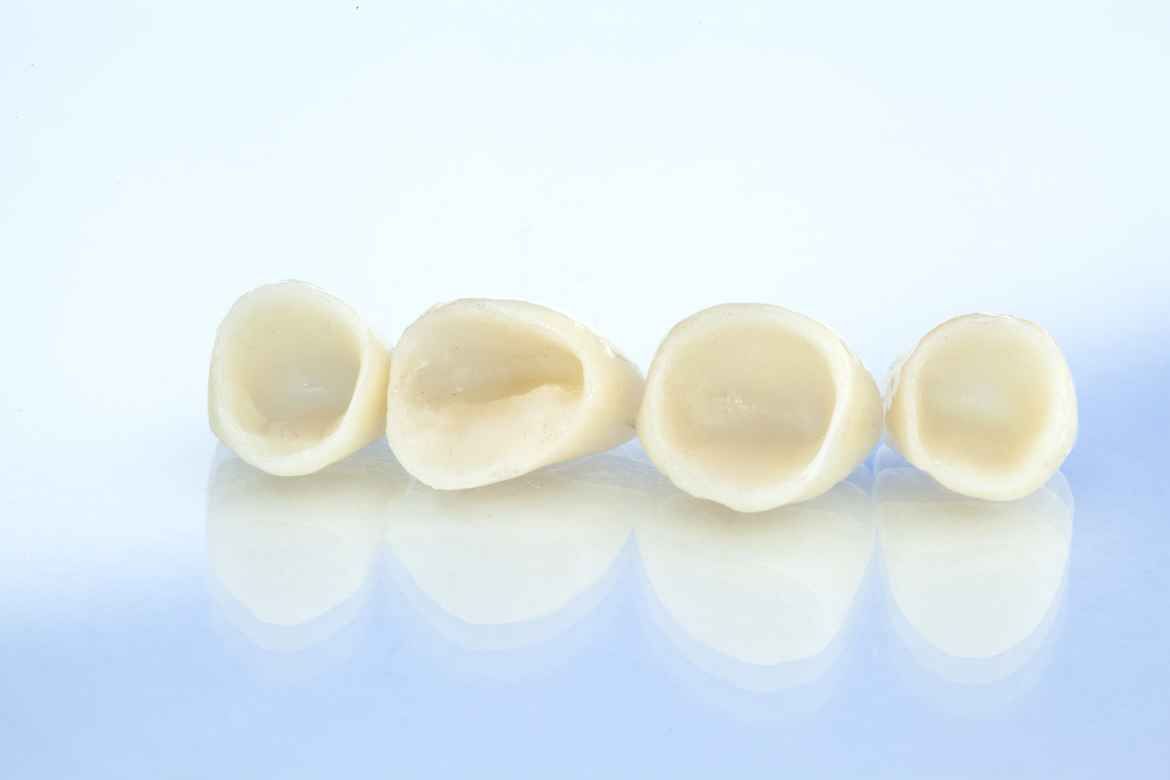 Coroas Dentárias